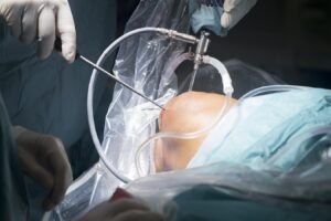 what is arthroscopic surgery