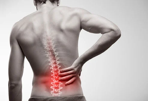 How to Manage Lower Back Pain