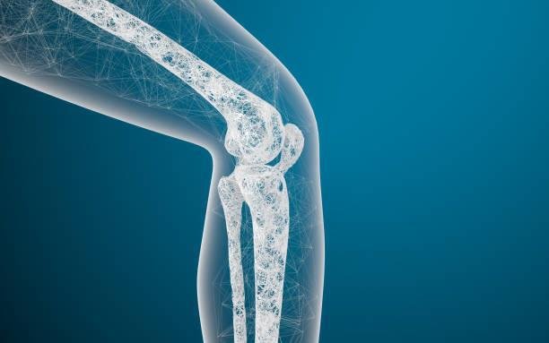 Osteoporosis & Aging Understanding the Bone Health Connection