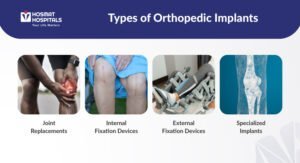 Types of Orthopedic Implants