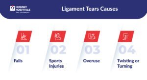 Ligament Tears Causes