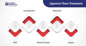 Ligament Tears Treatment