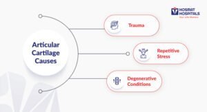 Articular Cartilage Causes