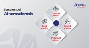 Symptoms of Atherosclerosis