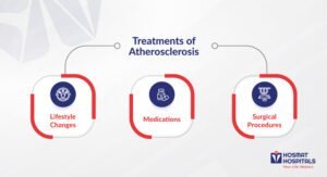 Atherosclerosis Treatments 